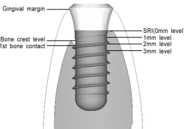 Figure 1. Schematic drawing presenting the location of various histometric measurements(SRI, smooth-rough  surface interface; 0mm level, the vertical point for measuring the horizontal thickness of gingiva and bone; 