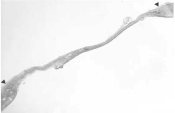 Figure 4. Representative photomicrographs of defect  site receiving the positive control at 2weeks(arrow  heads : defect margin ; HE stain, magnification X 10).