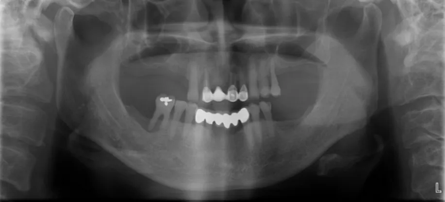 Figure 6. Preoperative panoramic view.