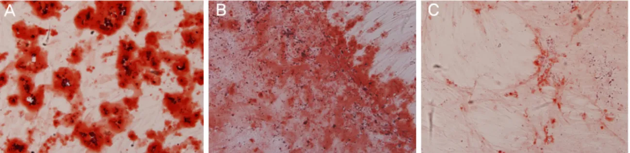 Figure 2. Osteogenic differentiation (A) PDLSC (B) ABSC (C) BMSC (Alizarin red S, Original magnification x100).