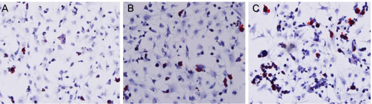 Figure 3. Adipogenic differentiation (A) PDLSC (B) ABSC (C) BMSC (Oil Red O staining, Original magnification x100)