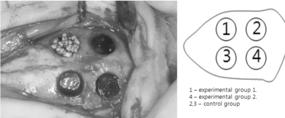 Figure 1. NU- Oss Ⓡ  and PLGA graft in Calvarial bony defect.