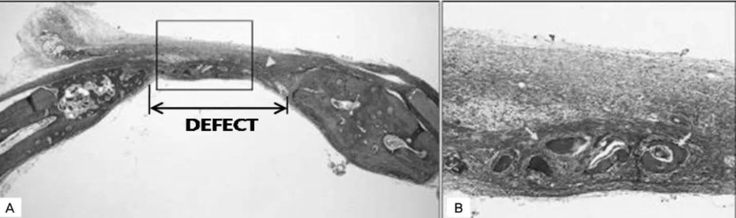Figure 2. control group, 2 weeks post-surgery : The bone defect was partially recovered by newly formed bone tissue, but  the central part was changed into fibrous connective tissue