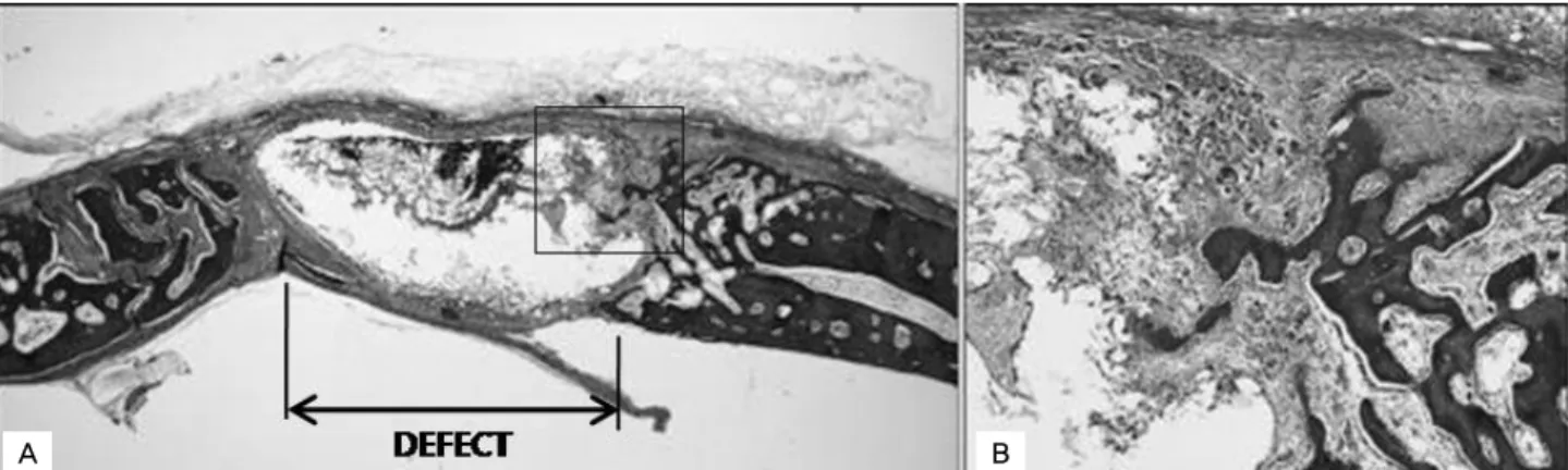 Figure  5. experimental group, 1 ,4 weeks post-surgery; The bone tissue showing bony change was far matured but bone  growth through bone graft was slight