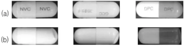 Fig.  1.  (a)  Normal  Capsule  (b)  Dented  Capsule