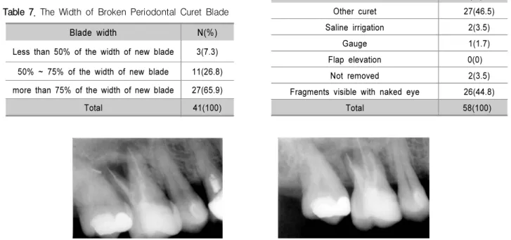 Table 7. The Width of Broken Periodontal Curet Blade