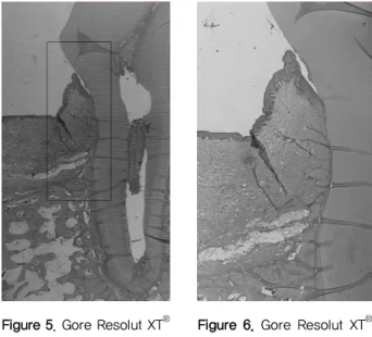 Figure 7. Osteoguide ®  8weeks (x10, H-E)