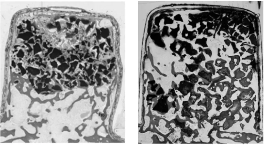 Table 2. New Bone Formation and Residual Graft Material