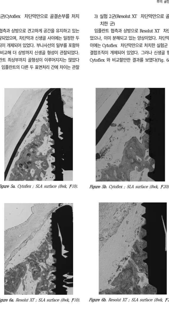 Figure 6b. Resolut XT ® ; SLA surface (8wk, × 20).