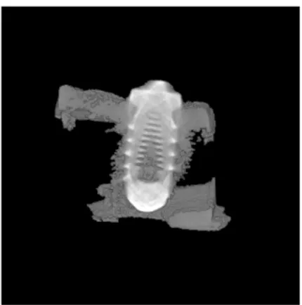 Figure 6. Micro CT view of machined surface  implant after 4 weeks.