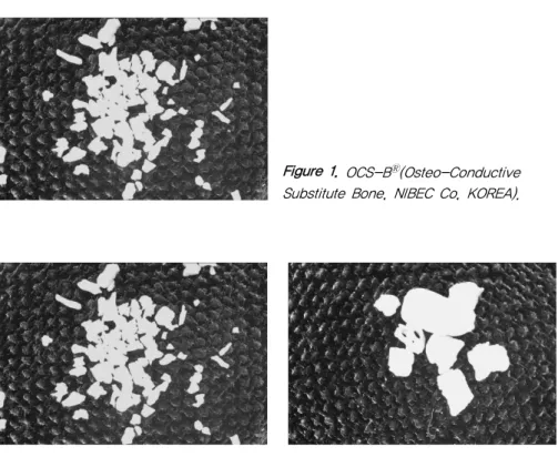Figure 2. OCS-B Ⓡ (80∼90 um) &amp; OCS-B Ⓡ (200∼1000 um).