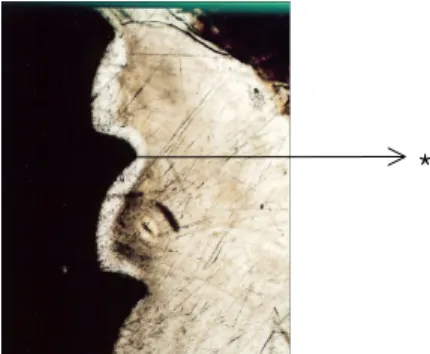 Figure 5. 4 weeks after surgery-no graft mate- mate-rial: polarization microscopic view x40, *: area  of no bone.