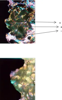 Figure 7. 4 weeks after surgery -200∼1000 um  particle  size  graft  materials  area-polarization microscope x100.