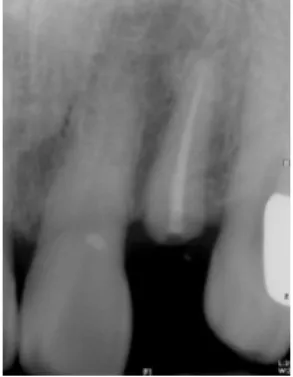 Figure  1.  Clinical  photograph  before 