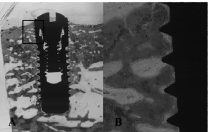 Figure 4. Histologic view of experimental group 1. (Anodized surface + HA 150nm coating +430ﾟC  heat treatment implant) A: maginification (×10), B: H-E staining (×100)