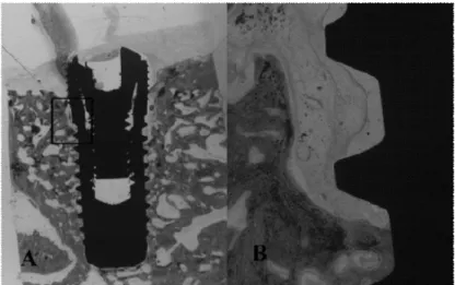 Figure 6. Histologic view of experimental group 3. (Anodized surface + HA 150nm coating  no heat  treatment implant) A: maginification (×10), B: H-E staining (×100).