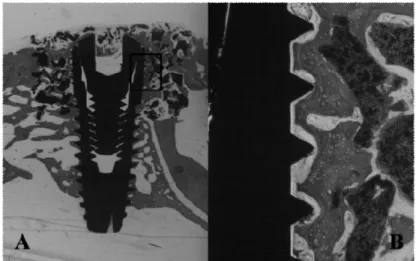 Figure 7. Histologic view of experimental group 4. {Anodized surface implant + Bone (Osteon ® : HA+ 