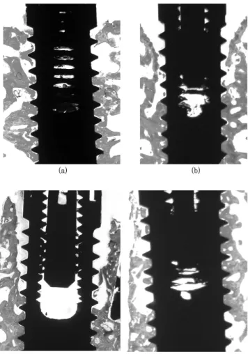 Figure 6. Histologic view of group A (turned  surface) in 1 mm gap defect with tapered  de-fect morphology (a) and with paralleled dede-fect  morphology (b), H-E stain, magnification X8.