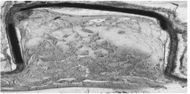 Figure  2.  The  control  group  of  4  weeks  (TG  -4w)       A  proper  space  was  provided  by  the  fixed 