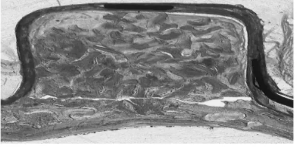 Figure  5.  (TG+DBB+4%  polyP  8weeks)          Trabecular  bone  formation  near  the  