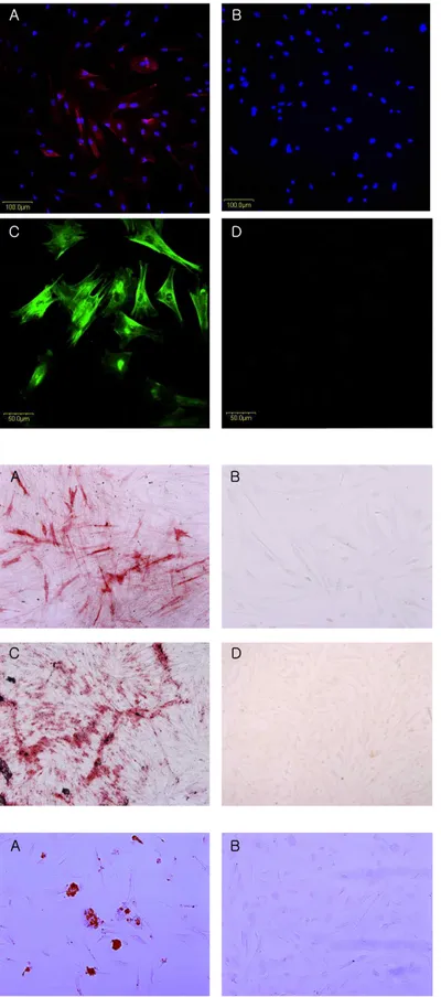 Figure  2.   성견의  치주인대세포에서  발현되 고 있는 CD146과 STRO-1. 중간엽줄기세포 의 표지인자인 CD146/MUC18(A,B)와 STRO  -1(C,D) 의 발현을 면역형광염색법으로 염 색을  하였다