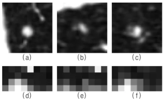 Fig.  5.  The  input  images  and  the  extracted  log-polar  sampling  features  of  isolated  nodule  ((a,d)  axial,  (b,e)  coronal,  and  (c,f)  sagittal  slices).