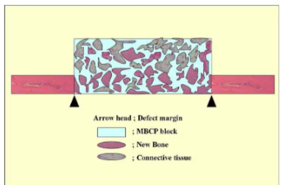 Figure 2. Schematic diagram of the calvarial osteotomy defect showing histometric analysis.