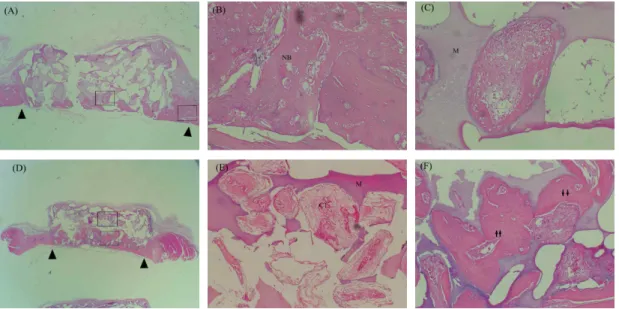 Figure 3. Representative photomicrographs of the MBCP control group at 2 (A,B and C) and 8 weeks (D,E and F) (arrow head: defect margin; arrow: cement lines, M;MBCP, NB: new bone, CT; connective tissue, H-E stain; original magnification A and D x20, B,C,E 