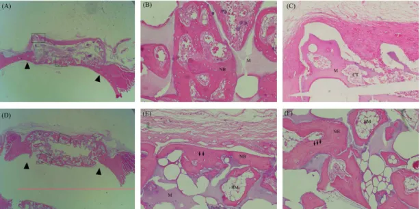 Figure 4. Representative photomicrographs of the rhBMP-2/MBCP group at 2 weeks (A,B and C) and 8 weeks (D,E and F) (arrow head: defect margin, arrow: cement lines, M;MBCP, NB: