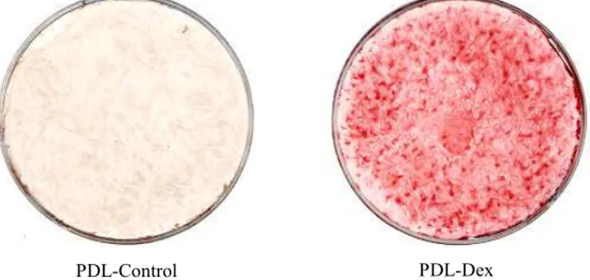 Figure 1. Alizarin red S staining of calcified matrix around PDL cells cultured for 21 days without (PDL-Control) and with mineralization supplements (50ug/ml ascorbic acid, 10mM β -glycerophosphate and 100nM dexamethasone) added to the culture medium(PDL-