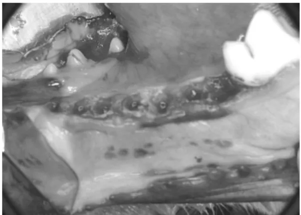 Figure  2.  Interrupted  suture  after  Transitional  Implant  placement