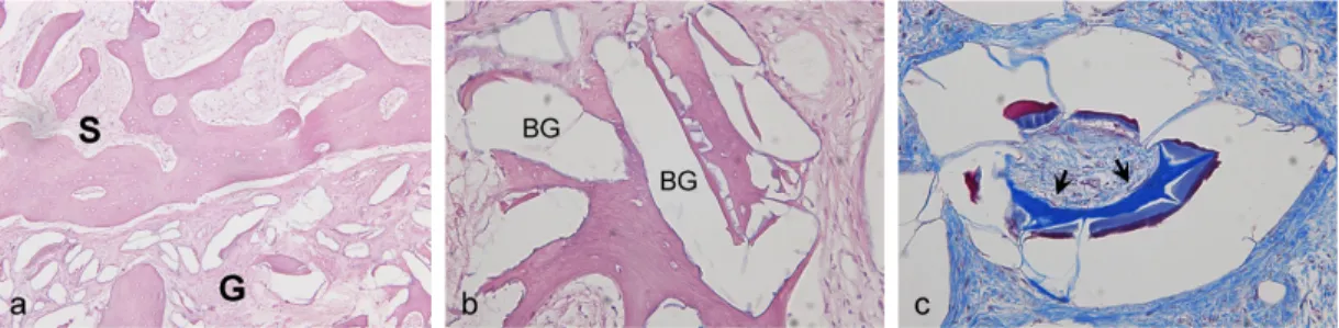 Figure  4.  Histological  section  of  bone  core  retrieved  18  months  after  grafting  (Case  4)
