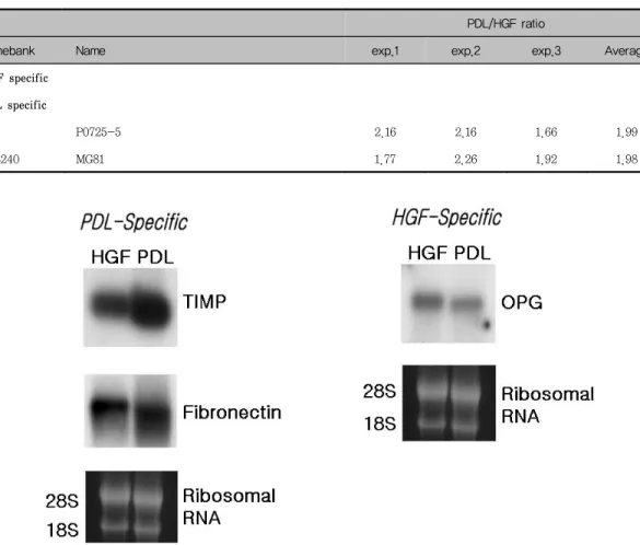 Figure  1.  Northern  blot  analysis  of  gene  expression  of  PDL  cells  and  HGFs