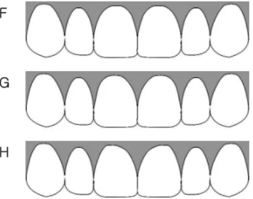 Figure  4.  Gingival  margin  shape  of  the  cen- cen-tral  incisor  -2/9  horizontal  component  of  the  crown  width