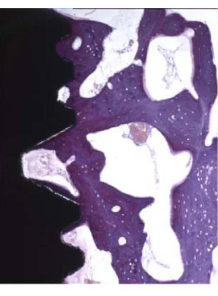 Figure  7.  Ground  section  (mesio-distal  plane)  of  autograft  sites  after  4  weeks(left)  and  8  weeks(right)  of  healing