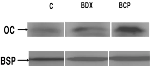 Figure 4. Western blot analysis for intracellular levels of OC and BSP in hFOB 1.19. First lane is control group and the second is BDX group, and the last one is BCP group