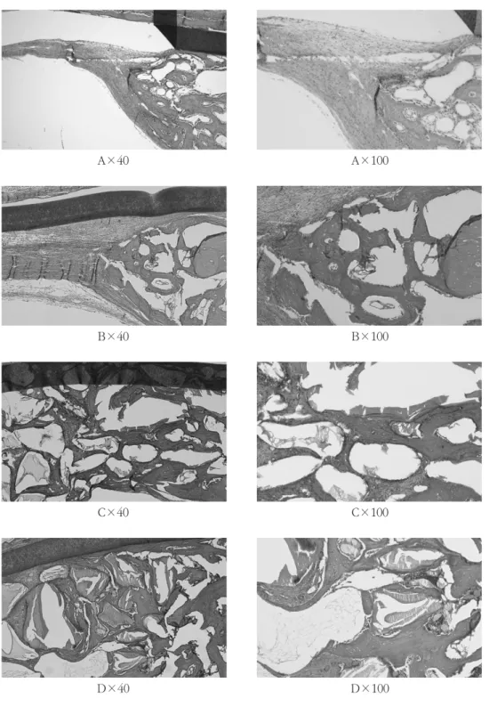 Figure 6. Light  micrographs at  1 week  postoperatively; control  (A), PRP  (B), Bio-Oss (C), and Bio-Oss with PRP (D)