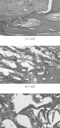 Figure 7. Light micrographs at 2 week postoperatively; control  (A), PRP  (B), Bio-Oss (C), and Bio-Oss with PRP (D)