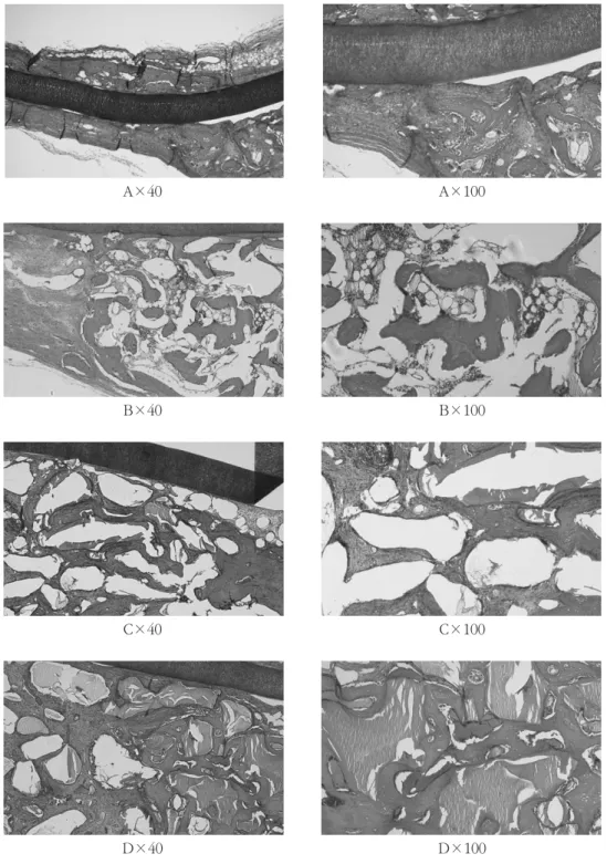Figure 8. Light micrographs at 4 week postoperatively; control  (A), PRP  (B), Bio-Oss (C), and Bio-Oss with PRP (D)