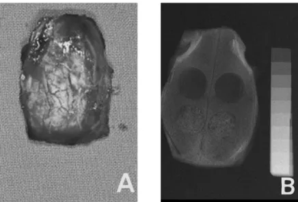 Figure 5 demonstrates the bone density as deter- deter-mined  radiographically.  Oss group  and   Bio-Oss with PRP group showed a significant increase in radiographic bone density when compared to the control and PRP group at all 3 time points(p<0.01).