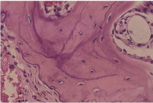Figure  2.  Histological  comparison  of  the  implants  developed  from  the  fibrin  glue/MSCs/BMP-2   ad-mixture  (A),  fibrin  glue/MSCs/PDGF-BB  adad-mixture  (B), or fibrin glue/MSCs/BMP-2/PDGF-BB  admix-ture  (C)  (HE,  x4)
