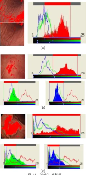 그림 11. 영상의 세분화 Fig 11. Segmentation of image