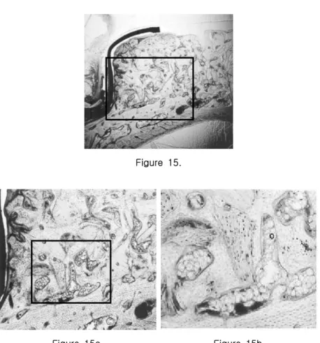 Figure  15a. Figure  15b.