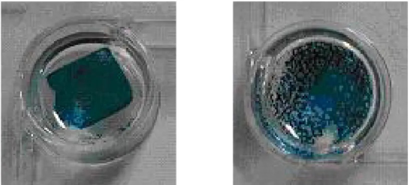 Figure  8.  콜라겐  지지체에  부착된  BMP-2  유전자도입치주인대세포의  주사전자현미경적  관찰  (A)  BMP-2  유전자가  도입된  치주인대세포,  (B)  대조군,  300X IV