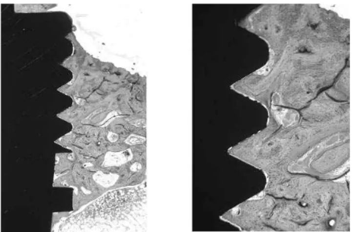 Figure  2.  Histological  section  in  mesiodistal  direction  of  anodized  implant;  Multiple  stain,  magnification  ☓40  (left),  ×100  (right) 
