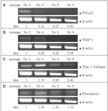Figure 4. Expression  of  differentially-expressed  genes  during  aging,  detected  in  hPDLF  from  an  19-year-old  donor  by  RT-  PCR