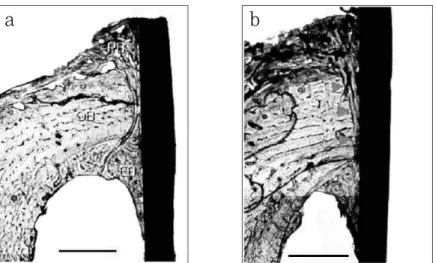 Figure  2.  Histologic  features  after  4  weeks  of  implant  installation,  stained  with  toluidne  blue New  bone  formation  is  observed  in  the  periosteal(PB)  and  endosteal(EB)  region
