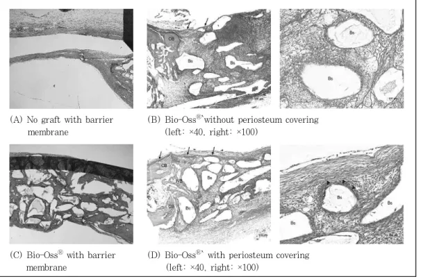 Figure  2.  Light  micrographs  at  1  week  postoperatively;  No  graft  with  barrier  membrane  (A),  Bio-Oss Ⓡ   without  periosteum  covering  (B),  Bio-Oss Ⓡ   with  barrier  membrane  (C),  and  Bio-Oss Ⓡ   with  periosteum  covering  (D)