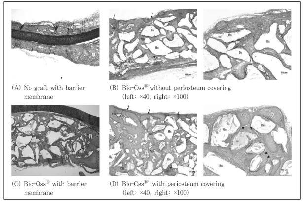 Figure  3.  Light  micrographs  at  2  week  postoperatively;  No  graft  with  barrier  membrane  (A),  Bio-Oss Ⓡ   without  periosteum  covering  (B),  Bio-Oss Ⓡ   with  barrier  membrane  (C),  and  Bio-Oss Ⓡ   with  periosteum  covering  (D)