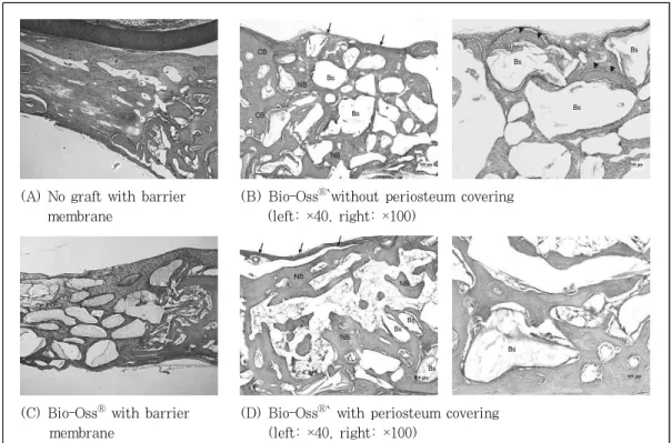 Figure  4.  Light  micrographs  at  4  week  postoperatively;  No  graft  with  barrier  membrane  (A),  Bio-Oss Ⓡ   without  periosteum  covering  (B),  Bio-Oss Ⓡ   with  barrier  membrane  (C),  and  Bio-Oss Ⓡ   with  periosteum  covering  (D)
